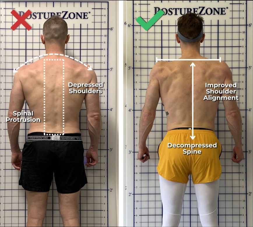 Corrective Exercise